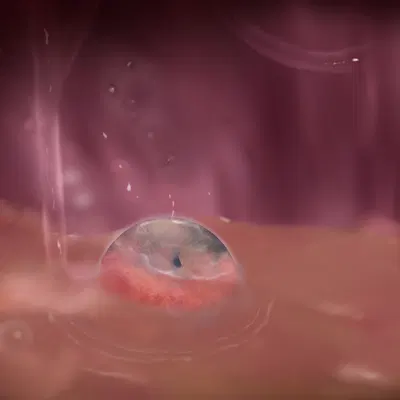 teruni-nemira-inamor created by teruni-inamor